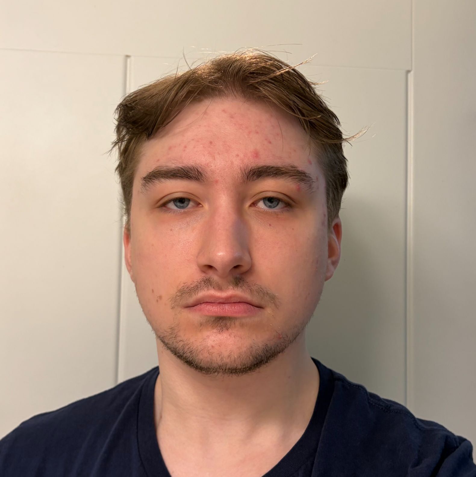 Profile of Aaron Shanaman