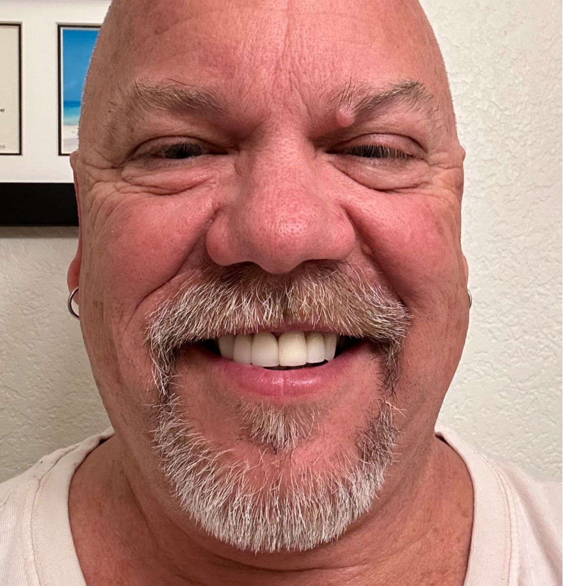 Profile of Shon Hall