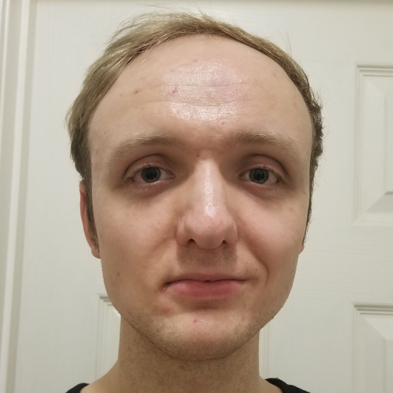 Profile of Anthony Onceler