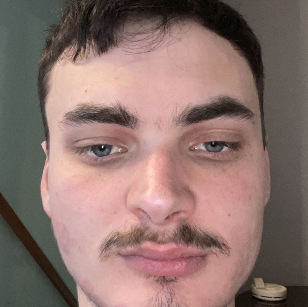 Profile of Edwin White