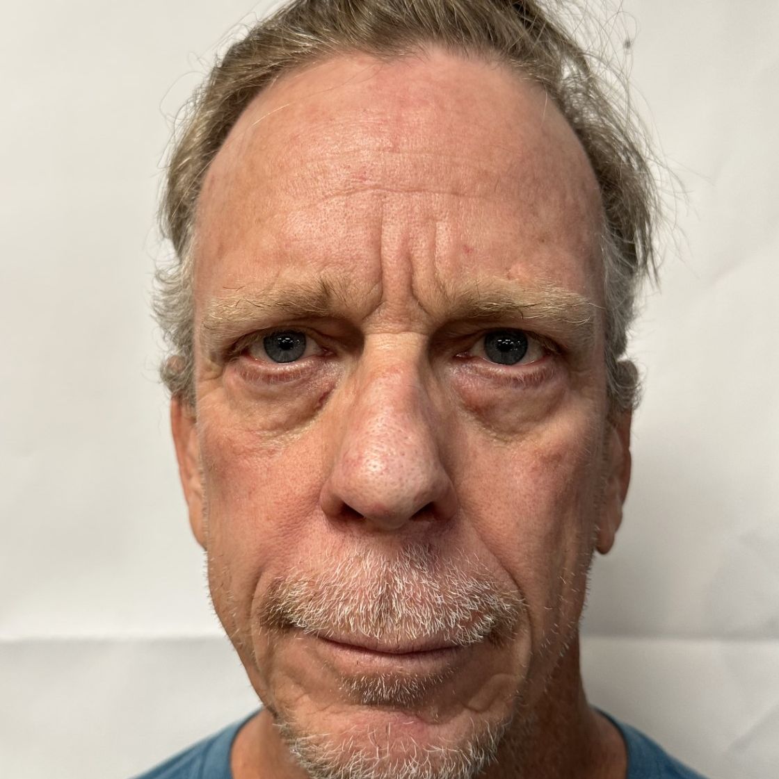 Profile of Sheldon Rosenbaum