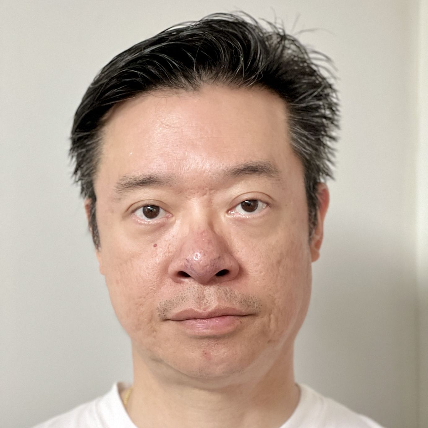 Profile of Albert Lau