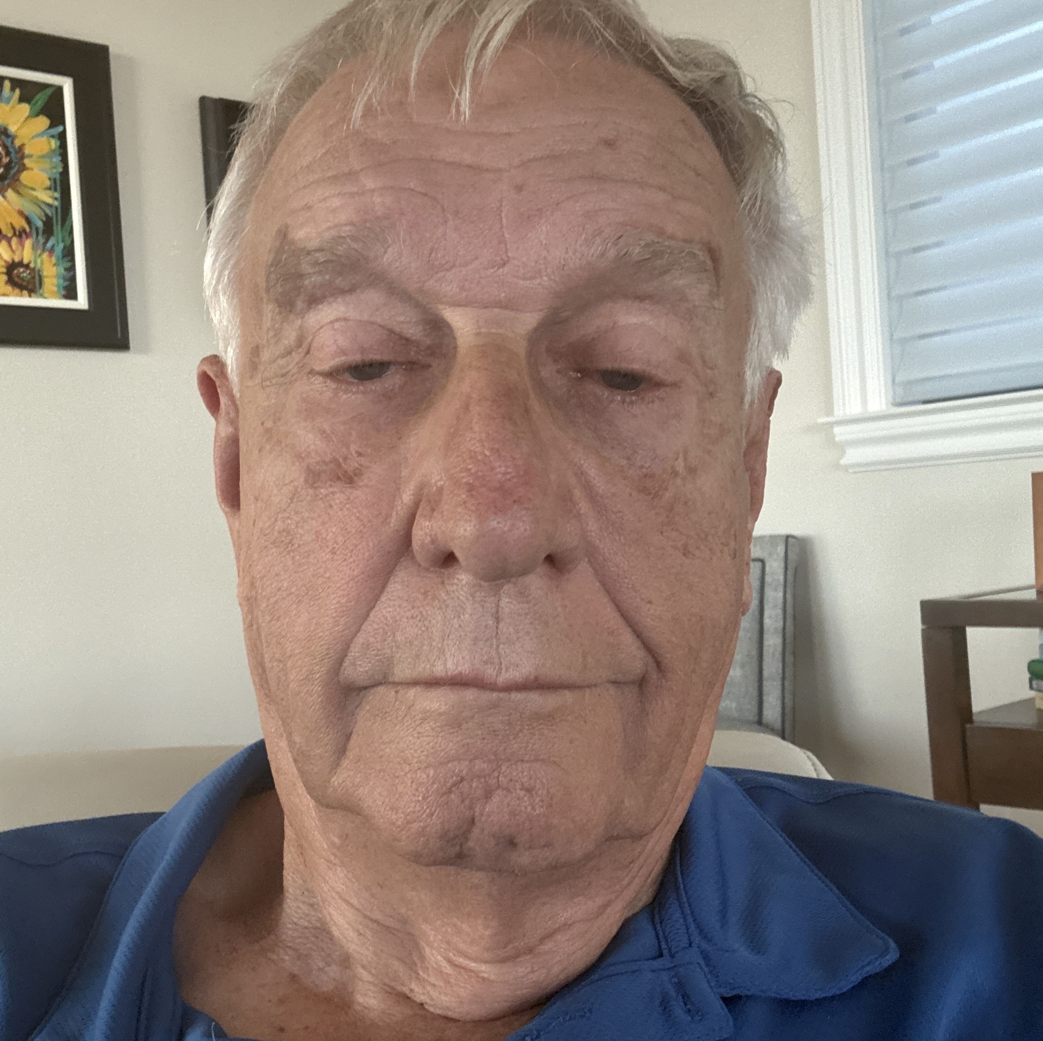 Profile of Bill Treffert