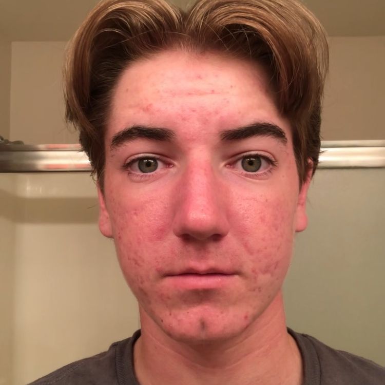 Profile of Greyson Lott