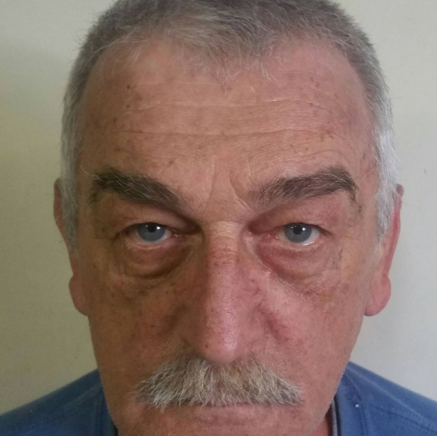 Profile of Frank Chynoransky