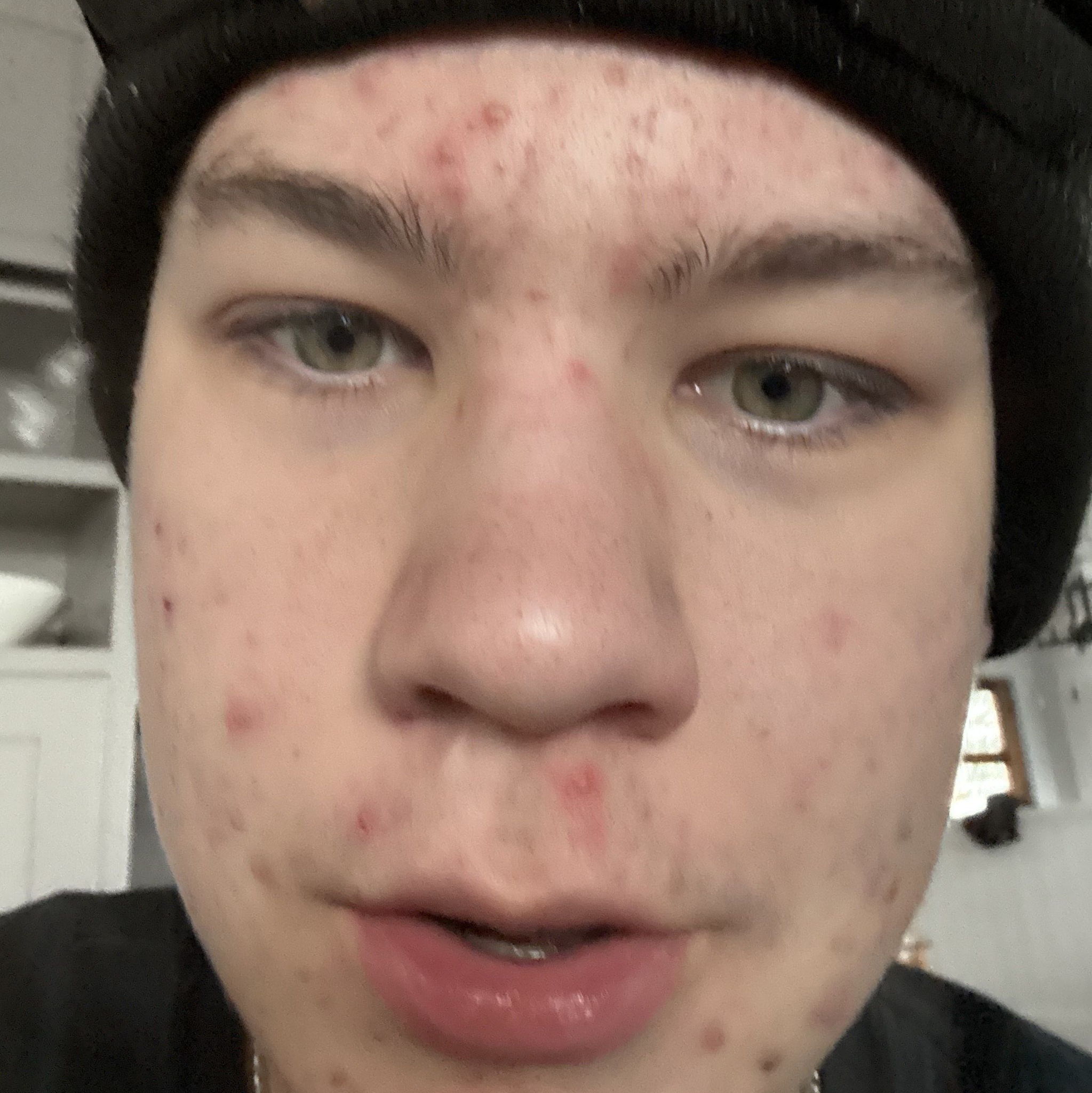 Profile of Aiden Coffelt