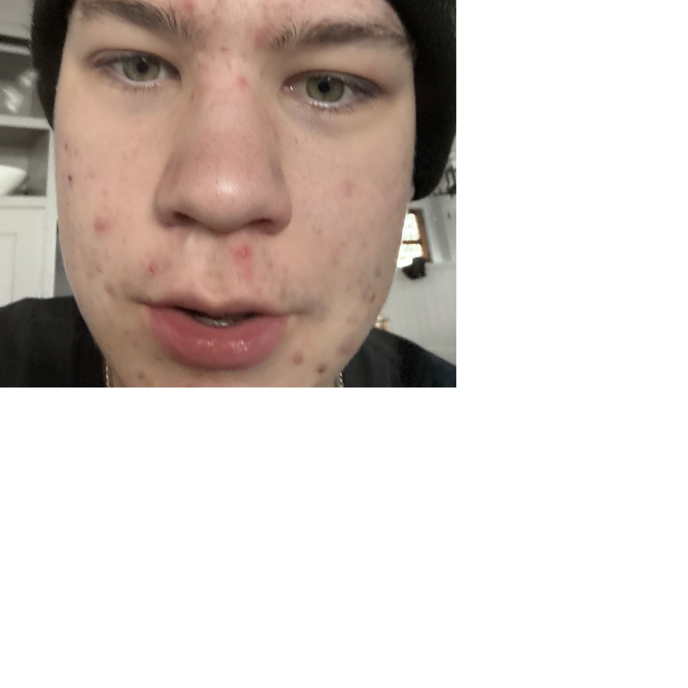 Profile of Aiden Coffelt
