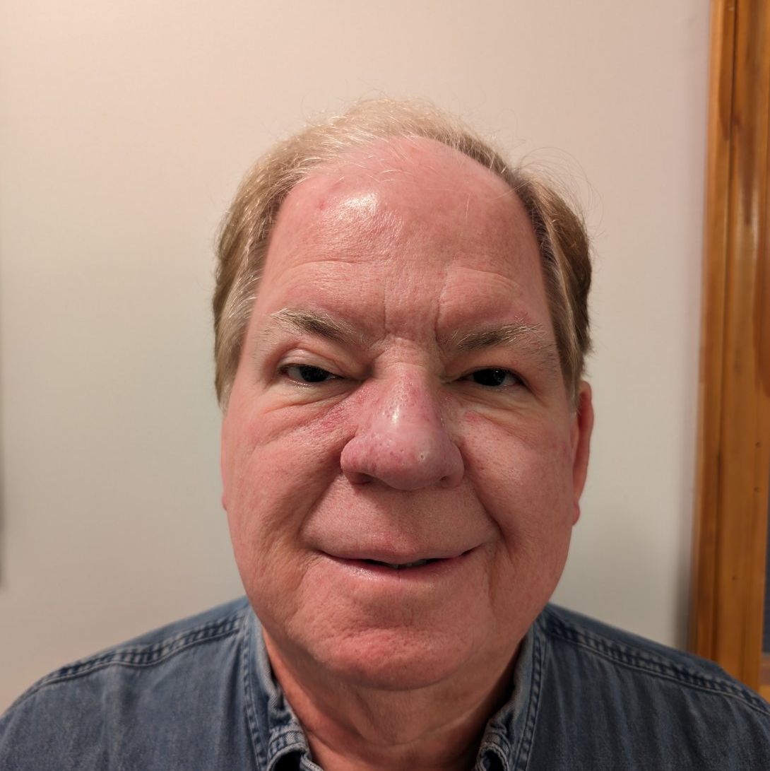 Profile of Ray Bonthron