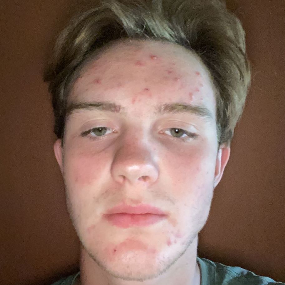 Profile of Reed Tensen