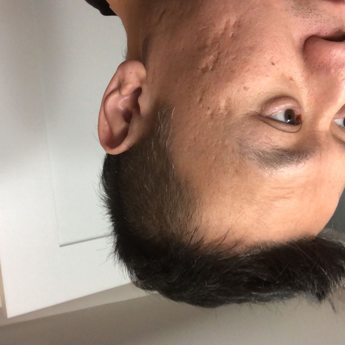 Profile of Joseph Lim