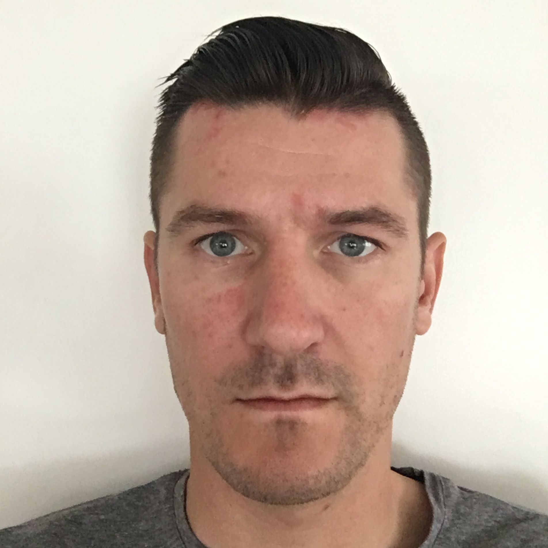 Profile of Phil Boznik