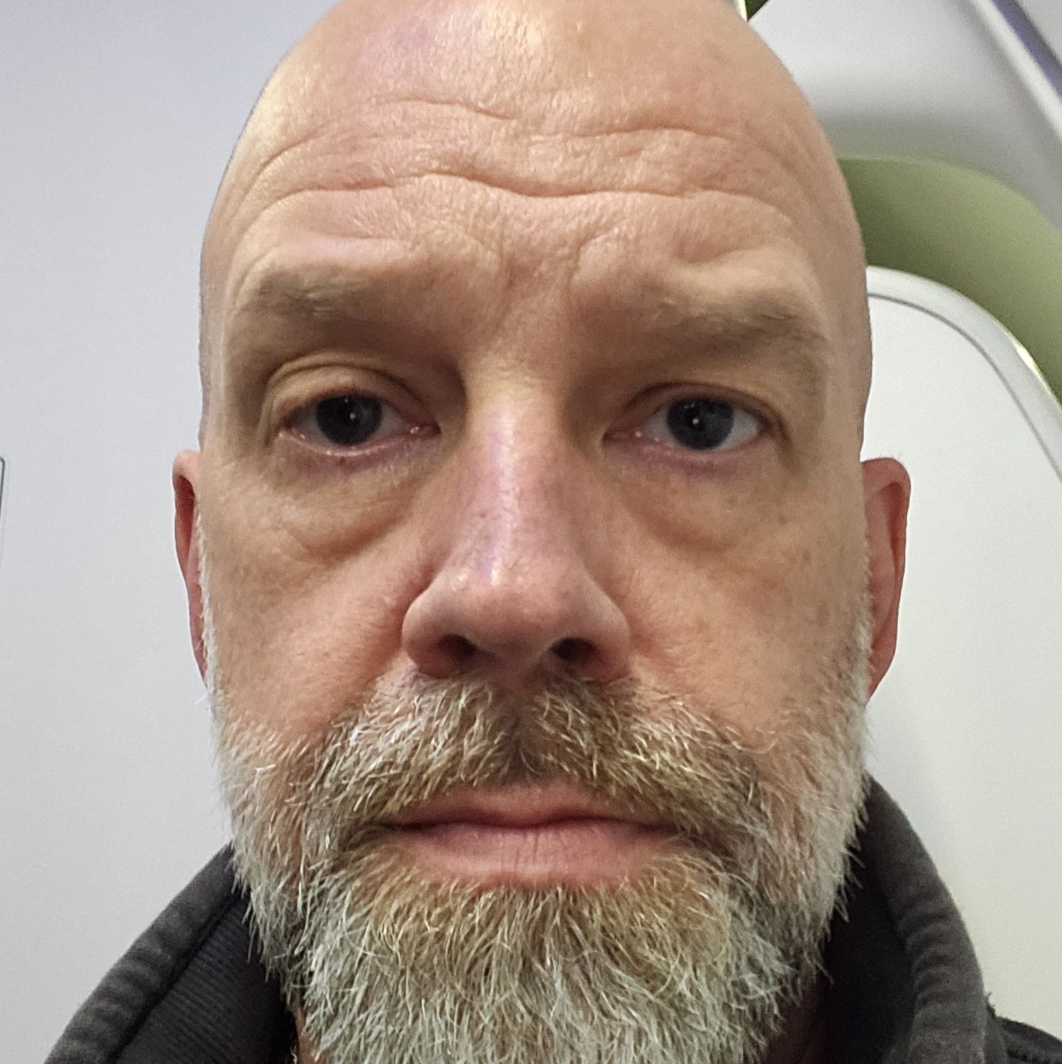 Profile of Mark Adkins