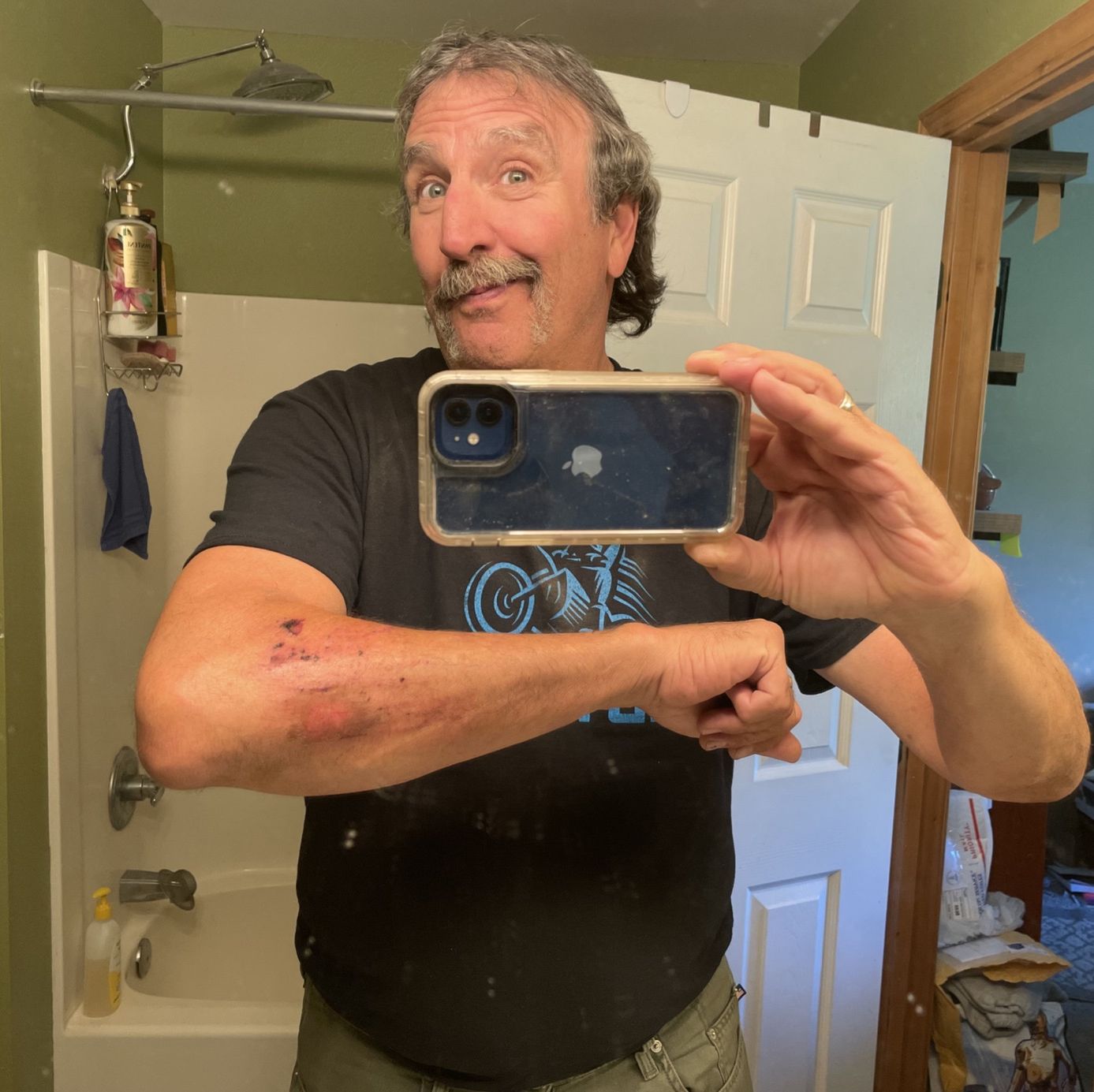 Profile of Richard Hersh